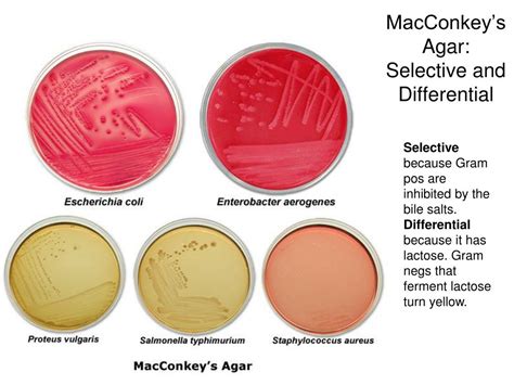 enterobacter aerogenes on emb|Selective and Differential Media for Identifying Microorganisms.